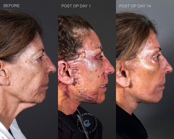 Image may contain Celia Snchez Head Person Face Adult Photography Portrait Body Part and Neck