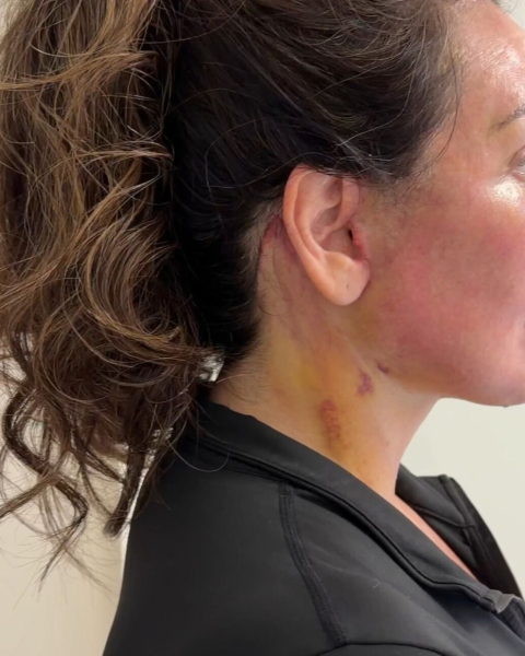 Image may contain Body Part Face Head Neck Person Adult and Skin