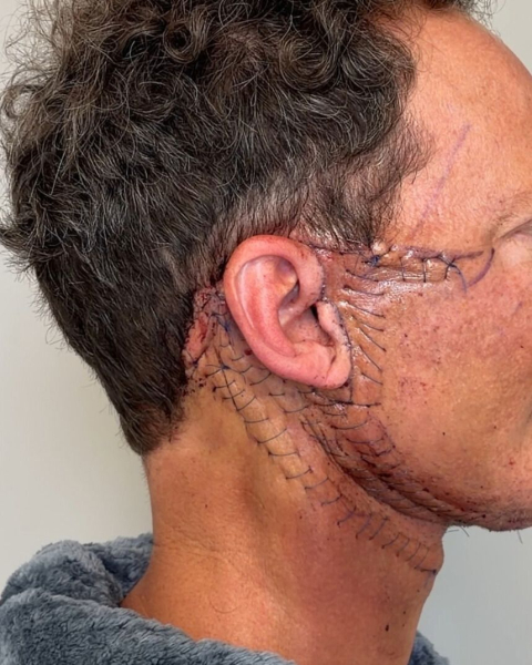 Image may contain Body Part Face Head Neck Person Adult and Skin